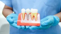 What Makes Dental Care in Bucharest So Popular?