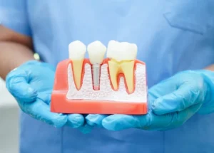What Makes Dental Care in Bucharest So Popular?
