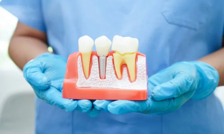 What Makes Dental Care in Bucharest So Popular?